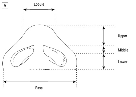 Line Drawing showing nostril proportions