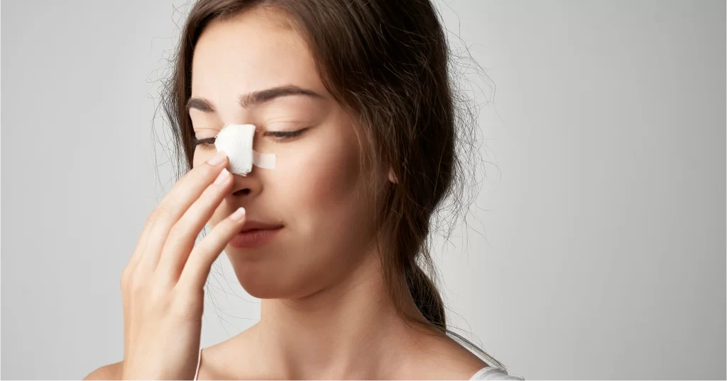 Photo of woman holding bandaged nose rhinoplasty Singapore