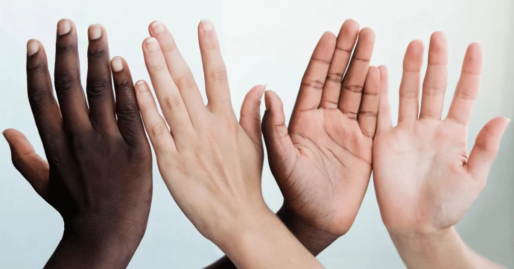 Photo of different color hands