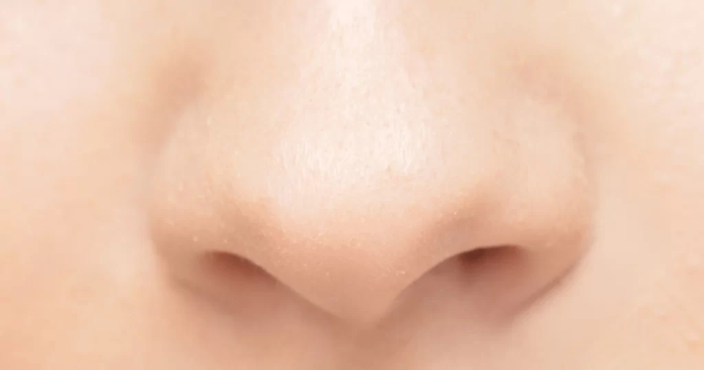 Photo of nose rhinoplasty singapore