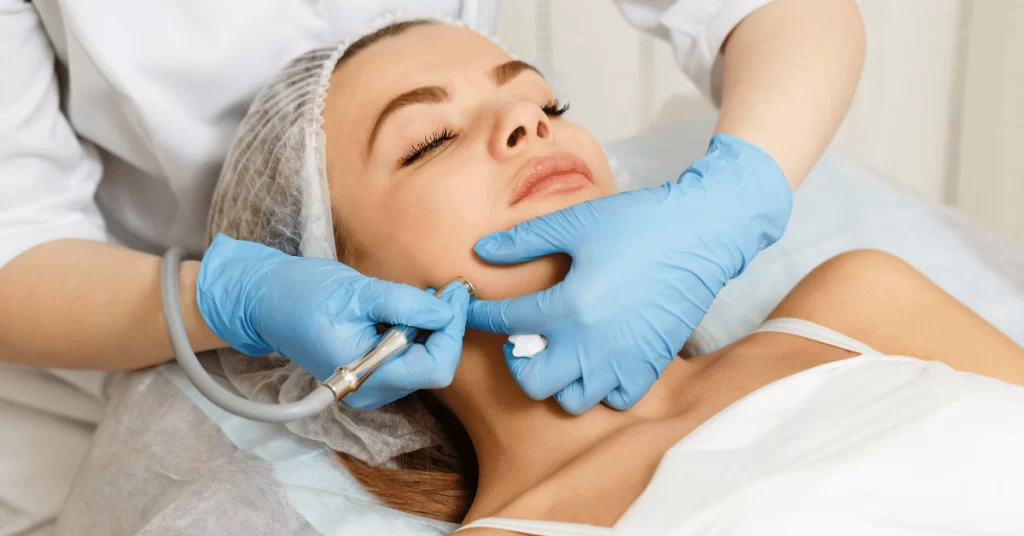 Photo of Dermabrasion Singapore