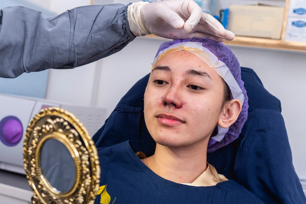 Woman doing rhinoplasty singapore