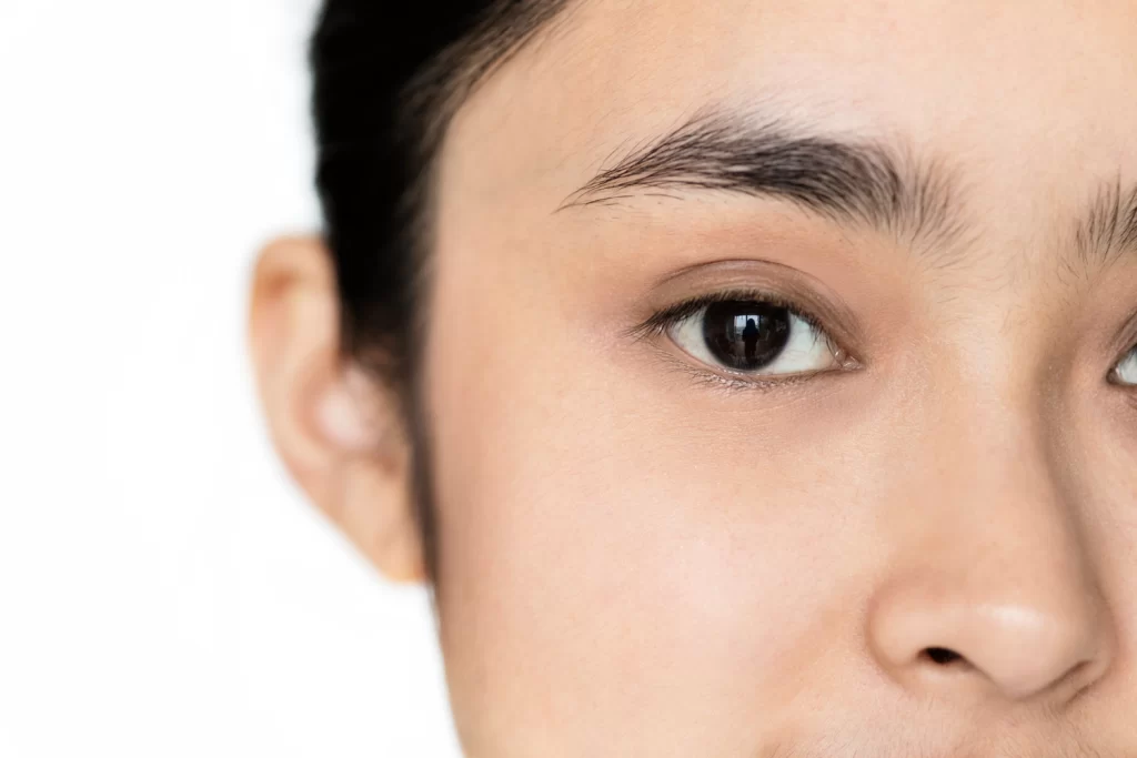 asian woman blepharoplasty singapore