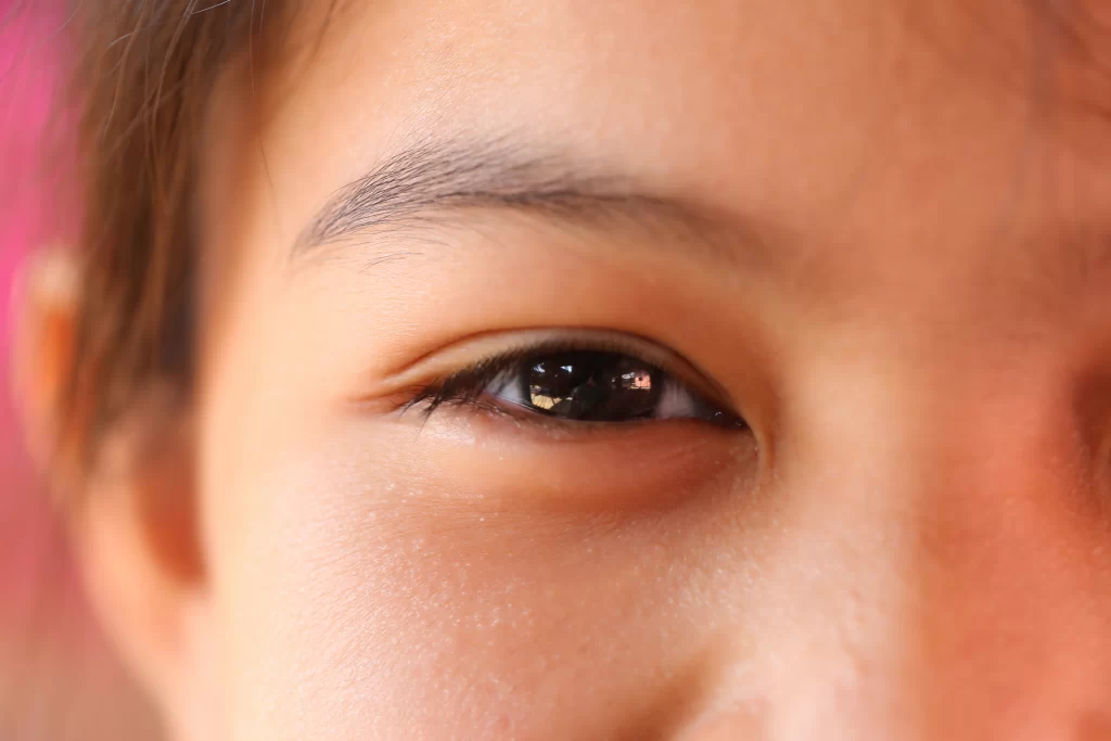 Photo of Asian child with double eyelid