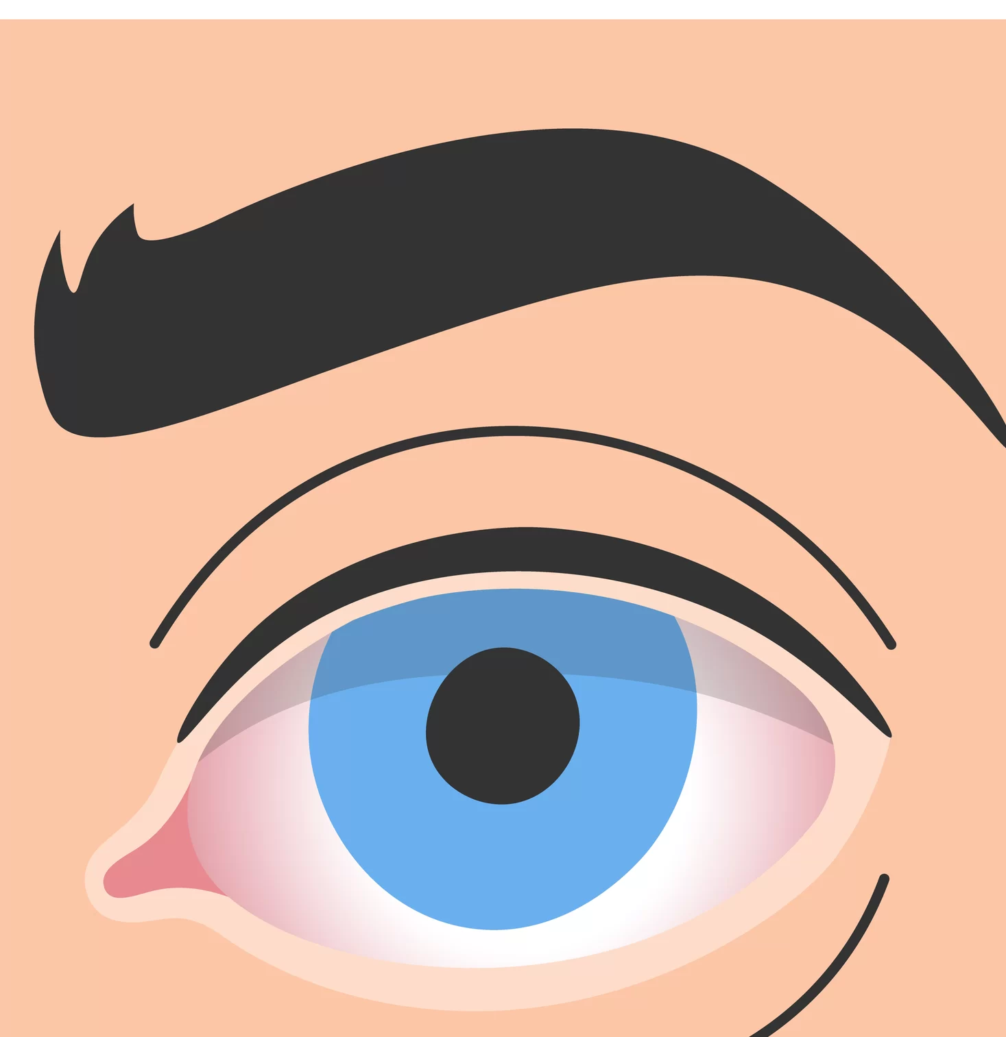 Illustration of dry eyes