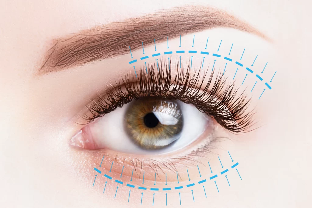 Photo of eyelid surgery treatment concept