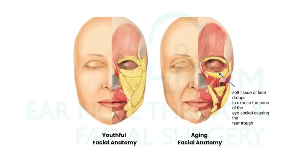 ageing facial anatomy