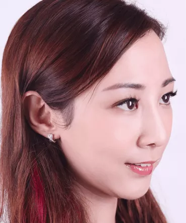 asian woman rhinoplasty nose